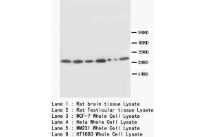 Western blot with SCN1B Polyclonal Antibody (SCN1B 抗体  (N-Term))