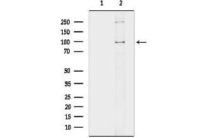 Western blot analysis of lysates from K562 cells(H2O2 treatment), using Progesterone Receptor Antibody.