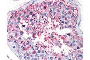 Anti-FSHR antibody IHC of human testis. (FSHR 抗体  (N-Term))