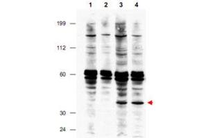 Western blot using FANCF polyclonal antibody  shows detection of FANCF present in a lysate prepared from a Fanconi anemia complementation group F patient lymphoblast after retroviral correction using hFANCF cDNA (lanes 3 and 4). (FANCF 抗体  (Internal Region))