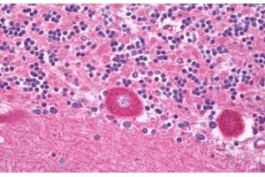 Anti-TRPV3 antibody IHC of human brain, cerebellum, Purkinje.