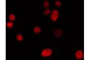 ABIN6274302 staining LOVO cells by IF/ICC. (IRX1 抗体  (Internal Region))