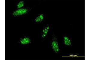 Immunofluorescence of monoclonal antibody to HAND2 on HeLa cell.
