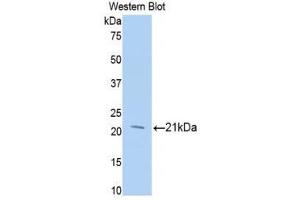 Western Blotting (WB) image for anti-Meningioma Expressed Antigen 5 (Hyaluronidase) (MGEA5) (AA 271-438) antibody (ABIN1859958) (MGEA5 抗体  (AA 271-438))