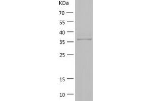 Western Blotting (WB) image for Solute Carrier Family 5 (Iodide Transporter), Member 8 (SLC5A8) (AA 464-610) protein (His-IF2DI Tag) (ABIN7125168) (SLC5A8 Protein (AA 464-610) (His-IF2DI Tag))