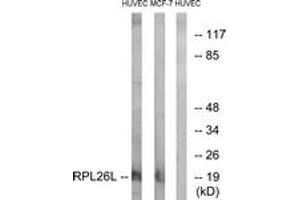 Western blot analysis of extracts from HuvEc/MCF-7 cells, using RPL26L Antibody. (RPL26L 抗体  (AA 96-145))