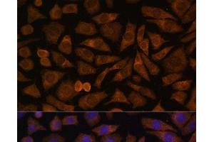 Immunofluorescence analysis of L929 cells using RABIF Polyclonal Antibody at dilution of 1:100 (40x lens). (RABIF 抗体)