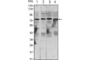 Western blot analysis using CHUK mouse mAb against Raji (1), Jurkat (2), THP-1 (3) and K562 (4) cell lysate. (IKK alpha 抗体)