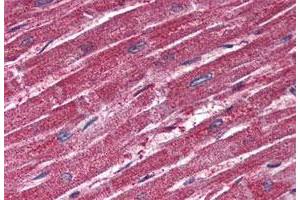 Immunohistochemistry (Formalin/PFA-fixed paraffin-embedded sections) of human heart tissue with TRPM4 polyclonal antibody . (TRPM4 抗体  (N-Term))