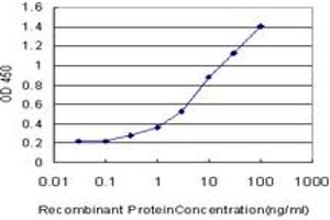 Detection limit for recombinant GST tagged CPT2 is approximately 0. (CPT2 抗体  (AA 351-450))