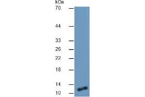 Mouse Capture antibody from the kit in WB with Positive Control: Sample Human A549 cell lysate. (CSTA ELISA 试剂盒)