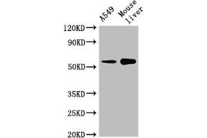 Western Blot Positive WB detected in: A549 whole cell lysate, Mouse liver tissue All lanes: CYP2A13 antibody at 1:2000 Secondary Goat polyclonal to rabbit IgG at 1/50000 dilution Predicted band size: 57 kDa Observed band size: 57 kDa (CYP2A13 抗体  (AA 252-354))