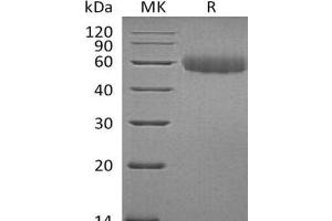 Western Blotting (WB) image for Triggering Receptor Expressed On Myeloid Cells-Like 2 (TREML2) protein (His tag) (ABIN7320674)