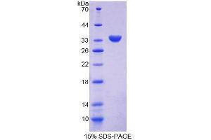 SDS-PAGE analysis of Human CHN2 Protein. (CHN2 蛋白)