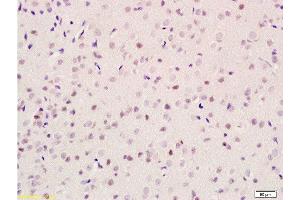 Formalin-fixed and paraffin embedded rat brain tissue labeled with Anti-GIG8/ID2 Polyclonal Antibody, Unconjugated  at 1:100 followed by conjugation to the secondary antibody and DAB staining (Id2 抗体  (AA 31-134))