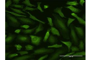 Immunofluorescence of purified MaxPab antibody to MALT1 on HeLa cell. (MALT1 抗体  (AA 1-813))