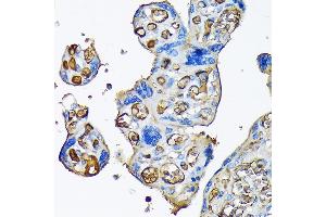 Immunohistochemistry of paraffin-embedded human placenta using Alpha-2-Macroglobulin (Alpha-2-Macroglobulin (M)) Rabbit mAb (ABIN7265558) at dilution of 1:100 (40x lens). (alpha 2 Macroglobulin 抗体)
