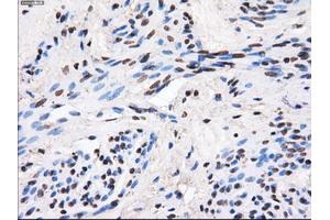 Immunohistochemical staining of paraffin-embedded Ovary tissue using anti-GBE1mouse monoclonal antibody. (GBE1 抗体)