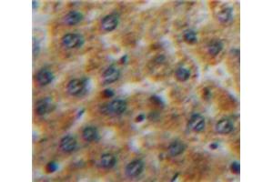 Used in DAB staining on fromalin fixed paraffin-embedded Liver tissue (TFPI 抗体  (AA 29-210))
