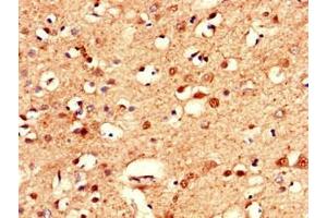 Immunohistochemistry of paraffin-embedded human brain tissue using ABIN7146589 at dilution of 1:100 (Calsyntenin 2 抗体  (AA 473-673))