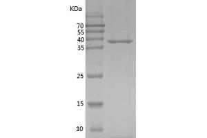 Western Blotting (WB) image for Mitogen-Activated Protein Kinase 8 (MAPK8) (AA 2-383) protein (His tag) (ABIN7123994) (JNK Protein (AA 2-383) (His tag))