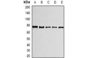 Western blot analysis of PRPF3 expression in A549 (A), HepG2 (B), THP1 (C), mouse spleen (D), mouse testis (E) whole cell lysates. (PRPF3 抗体)