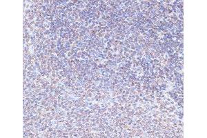 Immunohistochemistry (Paraffin-embedded Sections) (IHC (p)) image for anti-SNW Domain Containing 1 (SNW1) antibody (ABIN7257970)