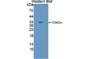 Western blot analysis of the recombinant protein. (ERBB3 抗体  (AA 709-966))
