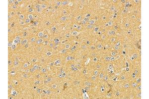 Nestin Mouse Monoclonal Antibody at 1/100 staining rat brain tissue by IHC-P. (Nestin 抗体  (C-Term))