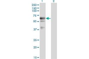 Western Blot analysis of LIPG expression in transfected 293T cell line by LIPG monoclonal antibody (M02), clone 1E11. (LIPG 抗体  (AA 21-500))