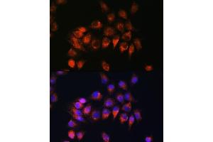 Immunofluorescence analysis of HeLa cells using BDKRB2 Rabbit pAb (ABIN3016822, ABIN3016823, ABIN3016824 and ABIN6219849) at dilution of 1:100. (BDKRB2 抗体  (AA 302-391))