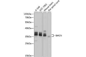 Western blot analysis of extracts of various cell lines, using EMCN antibody (ABIN6127867, ABIN6140148, ABIN6140150 and ABIN6218389) at 1:1000 dilution. (Endomucin 抗体  (AA 19-135))