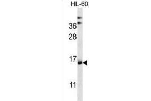 Western Blotting (WB) image for anti-NADH Dehydrogenase (Ubiquinone) 1 alpha Subcomplex, Assembly Factor 4 (NDUFAF4) antibody (ABIN2997063) (NDUFAF4 抗体)
