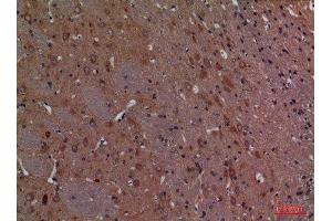 Immunohistochemistry (IHC) analysis of paraffin-embedded Rat Brain, antibody was diluted at 1:100. (CALB1 抗体  (C-Term))