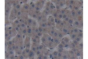 Detection of FAPa in Human Liver Tissue using Polyclonal Antibody to Fibroblast Activation Protein Alpha (FAPa) (FAP 抗体  (AA 523-760))