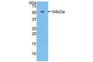 Detection of Recombinant FcgR3A, Rat using Polyclonal Antibody to Fc Fragment Of IgG Low Affinity IIIa Receptor (FcgR3A) (FCGR3A 抗体  (AA 5-241))