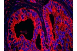 Immunofluorescence (IF) image for anti-Ankyrin Repeat and Sterile alpha Motif Domain Containing 1B (ANKS1B) (AA 245-268) antibody (ABIN7448954)