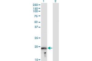 Western Blot analysis of MYLPF expression in transfected 293T cell line by MYLPF monoclonal antibody (M05), clone 3H3. (MYLPF 抗体  (AA 1-169))