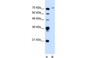 Western Blotting (WB) image for anti-Solute Carrier Organic Anion Transporter Family, Member 6A1 (SLCO6A1) antibody (ABIN2462781) (SLCO6A1 抗体)
