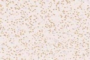 Immunohistochemistry analysis of paraffin-embedded mouse striatum using,SUN2 (ABIN7075502) at dilution of 1: 4000