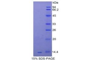 SDS-PAGE (SDS) image for Serum Amyloid A (SAA) (AA 20-122) protein (His tag) (ABIN1080801)