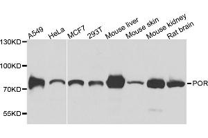 Western blot analysis of extracts of various cell lines, using POR antibody (ABIN5974791) at 1/1000 dilution. (POR 抗体)