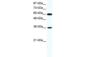 Western Blotting (WB) image for anti-Forkhead Box F1 (FOXF1) antibody (ABIN2460274) (FOXF1 抗体)