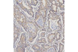 IHC analysis of TRPV3 using anti-TRPV3 antibody (ABIN7601087).