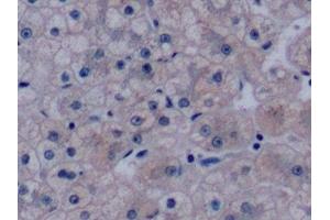 Detection of VEGF165 in Human Liver Tissue using Monoclonal Antibody to Vascular Endothelial Growth Factor 165 (VEGF165) (VEGF 165 (AA 28-191) 抗体)