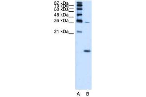 WB Suggested Anti-HBZ  Antibody Titration: 1. (HBZ 抗体  (N-Term))