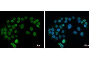 ICC/IF Image Islet 1 antibody detects Islet 1 protein at nucleus by immunofluorescent analysis. (ISL1 抗体)