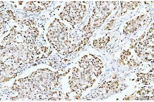 IHC analysis of Cyclophilin E/PPIE using anti-Cyclophilin E/PPIE antibody (ABIN7599242). (PPIE 抗体  (AA 1-301))