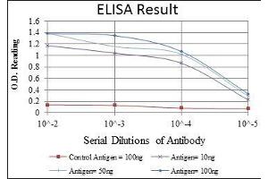 Red: Control Antigen (100 ng), Purple: Antigen (10 ng), Green: Antigen (50 ng), Blue: Antigen (100 ng), (Caspase 8 抗体)