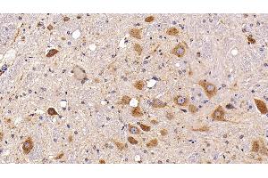 Immunohistochemistry (IHC) image for anti-Prosaposin (PSAP) (AA 17-524) antibody (ABIN7435130)